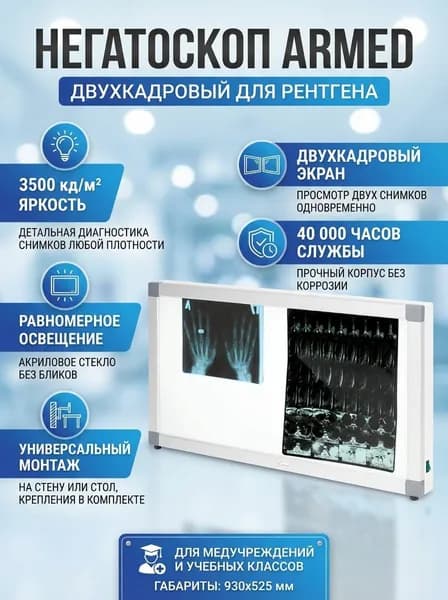 Негатоскоп Armed двухкадровый для рентгена, 930x525мм, акриловое стекло, стальной корпус с порошковым покрытием, для просмотра снимков, 2 лампы, 3500кд/м2, 95Вт