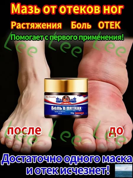 Лечебная мазь от опухоли ног после травмы, снимает отёчность и воспаление при растяжении, помогает при гемат