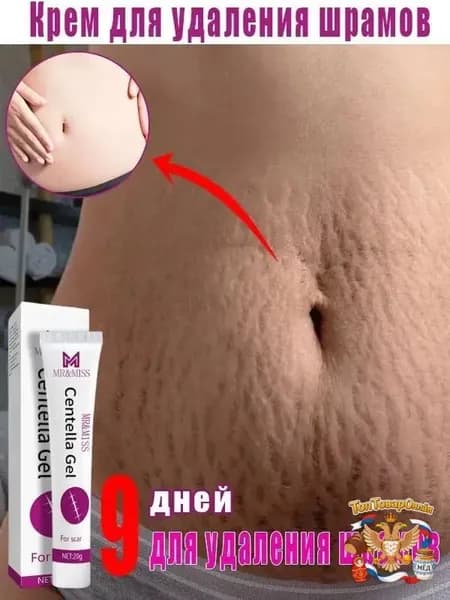 Средство от растяжек