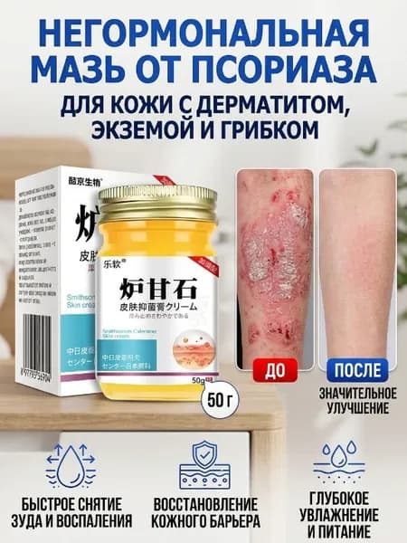 псорифенак мазь от псориаза, мазь при кожных заболеваниях. Гель от акне, экземы, дерматита, грибка, герпеса, угрей, сыпи и покраснений 50 гр.