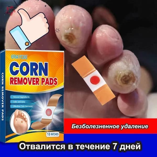 пластырь от сухих мозолей и натоптышей,10 наклеек,Пластырь от сухих мозолей стержневых, бородавок, натоптышей, шипиц и пяточных шпор, лейкопластырь