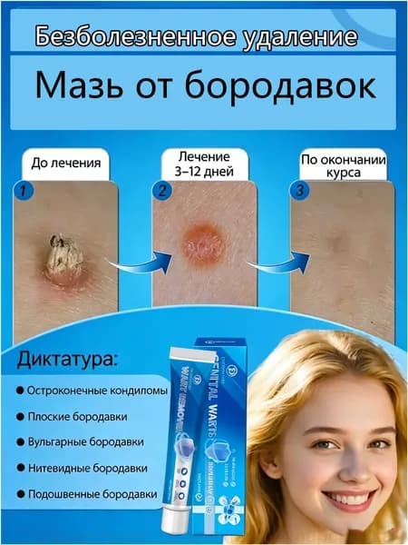 Эксклюзивный комплекс для удаления родинок, бородавок и папиллом, курс на 7 дней безболезненный и безопасный, 20 грамм