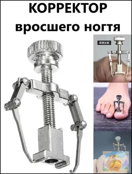 Корректор фиксатор вросшего ногтя