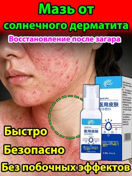 Крем для лечения солнечного дерматита,Восстановление кожи после солнечных ожогов крем после загара
