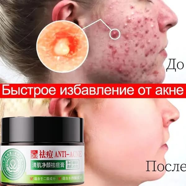 Крем для ухода за кожей
