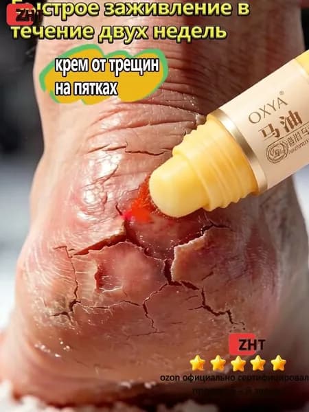 Крем воск от трещин для очень сухой кожи, крем для ног с мочевиной 5%, от трещин на пятках, воск для пяток
