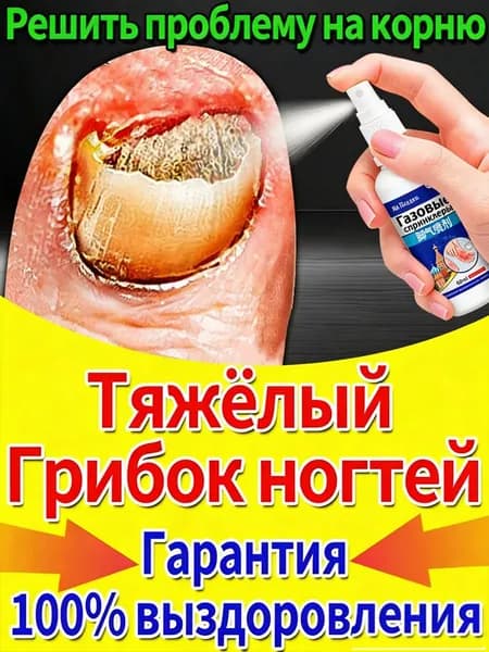 Спрей от грибка ногтей на ногах стоп онихолизис