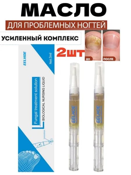 Противогрибковый лак для ногтей,Унисекс,Для лечения онихомикоза,Эффективный, не вызывающий раздражения
