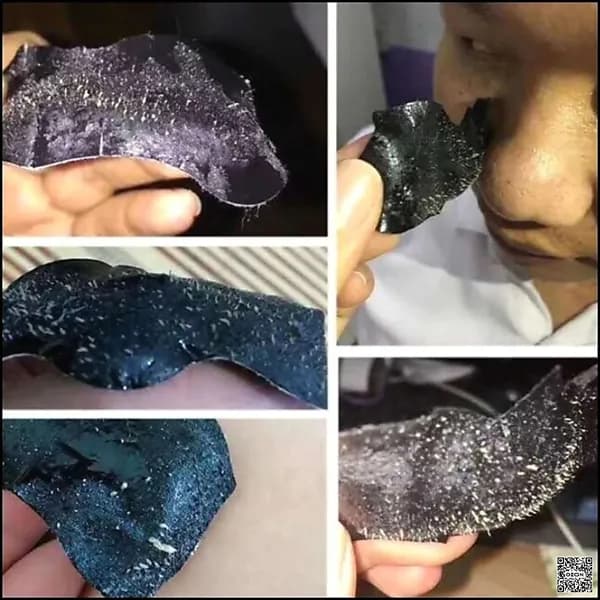 Эксклюзивные полоски для носа 10 шт обеспечивают глубокое очищение, устранение прыщей и угрей, сужение пор