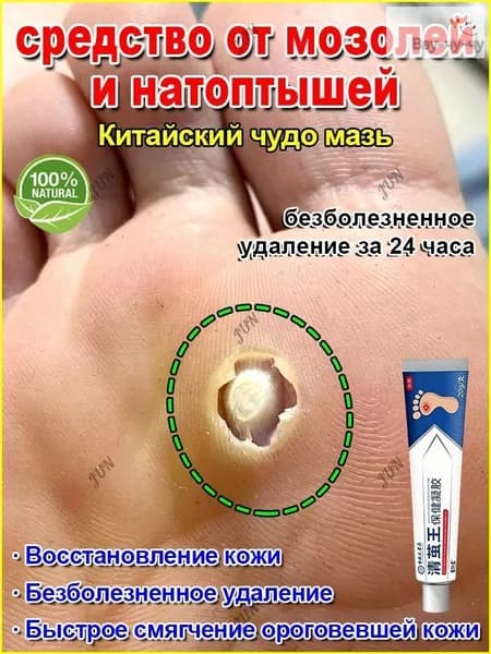 Пластырь от мозолей, бородавок и натоптышей лечебный, быстрое смягчение, безболезненное удаление,20 г.