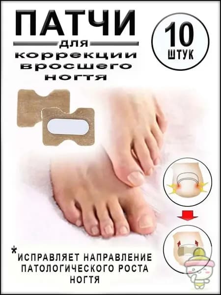 Пластыри для коррекции вросших ногтей на пальцах ног, 10 штук
