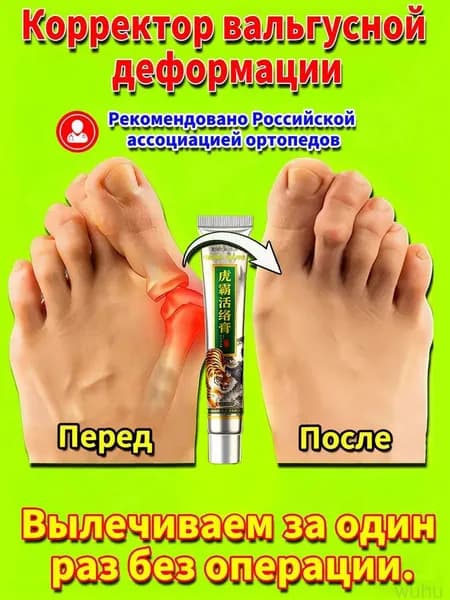 желчь медицинская.Китайская мазь для коррекции вальгусной деформации стопы,подагре и артрите