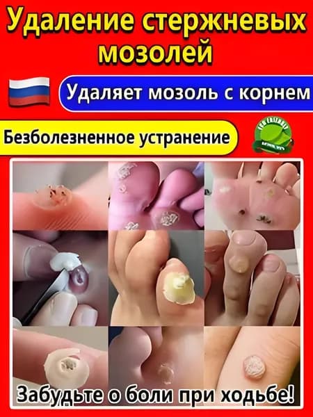 салипод от стержневых мозолей,мазь от натоптышей и на ногах,размягчитель для ухода и удаления , трещин и огрубевшей кожи на стопах средство для гладких пяток