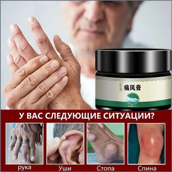 Популярный бальзам для устранения дискомфорта в плечах, пояснице, шее и ногах, объемом 35 г, применяемый для регенерации синовиальной жидкости коленных суставов и позвоночника