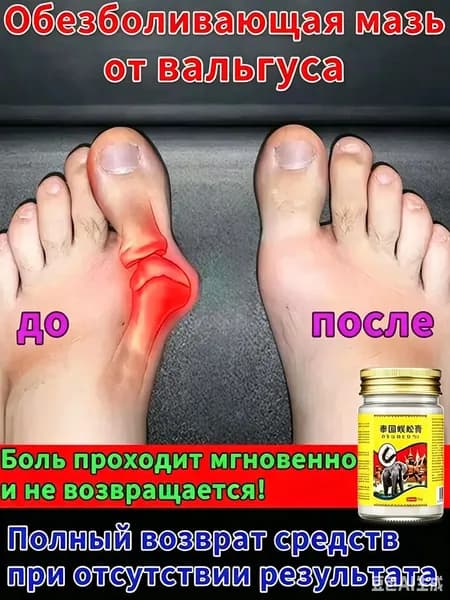 Китайская чудо мазь от вальгуса и косточки на ноге 55 г