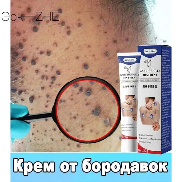 Профессиональный крем для удаления бородавок 20г, эффективен против вульгарных бородавок, папиллом и кератом, бережное удаление без повреждения здоровой кожи.