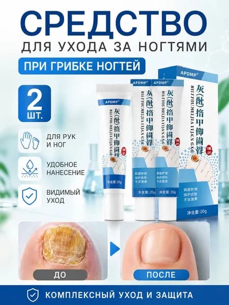 2 штуки,крем ноготок от грибка ногтей на ногах,ноготок мазь от грибка на ногах,гиперкератоз