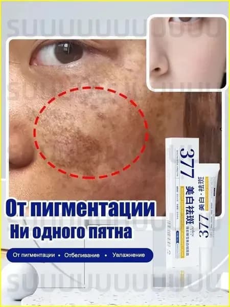 От пигментации Отбеливающий крем от пигментации AofuXue 30