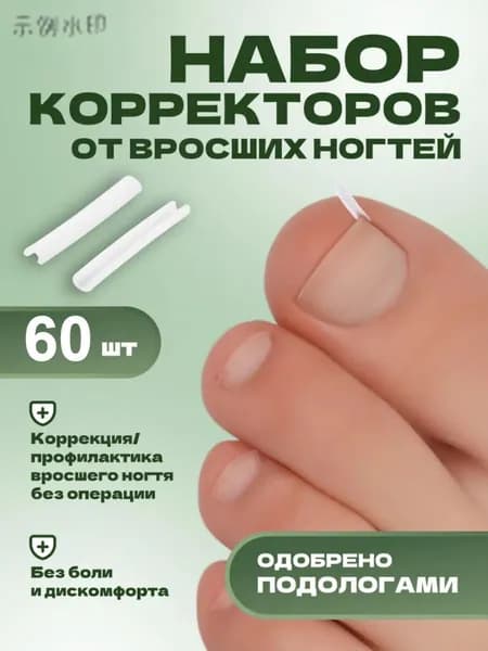 Корректор От Вросших Ногтей На Ногах