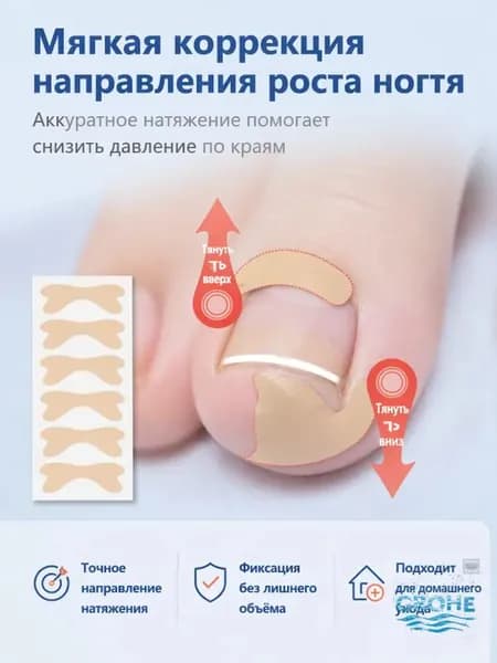 Наклейки от вросшего ногтя,20 шт