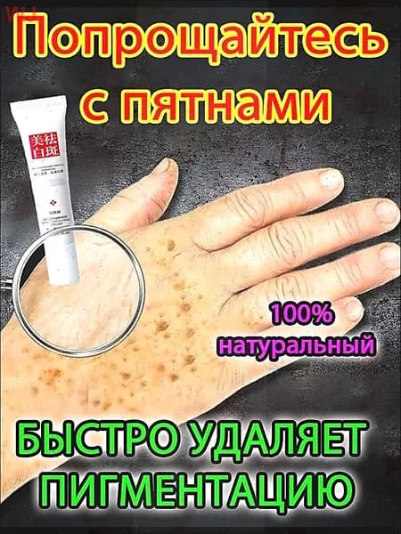 Отбеливающий крем от веснушек и солнечных пятен, подходит для удаления и исчезновения желтых пятен и старчес