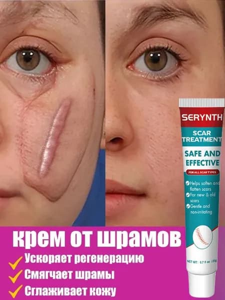 Гель от шрамов, крем от шрамов и рубцов, от постакне, от прыщей, крем от растяжек, от ожогов / 20 г