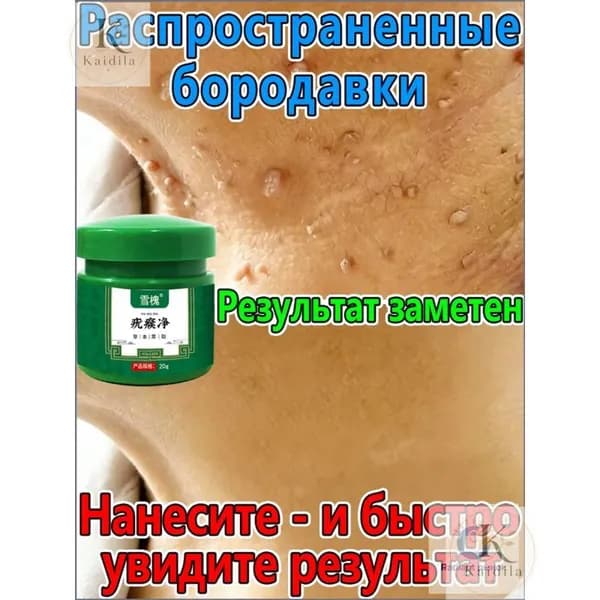 Средство для удаления кератом