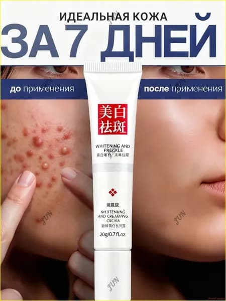 VOIS Крем для лица от воспалений с ниацинамидом,Точечный крем от прыщей,гель для лица от прыщей и черных точек точечный, корректирующий с ниацинамидом и цинком для проблемной кожи,20 г