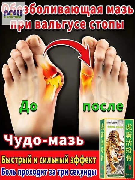 мазь от косточки на большом пальце, от шишек на больших пальцах ног
