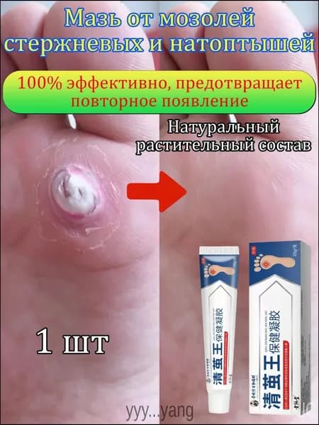 Mазь от мозолей стержневых и натоптышей ,Крем от сухих мозолей, шипицы, бородавок, натоптышей,20 г 1 шт.