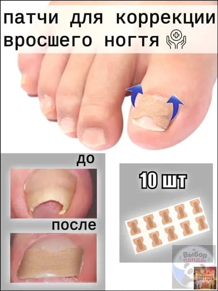 Пластыри для коррекции вросших ногтей на пальцах ног, 10 штук Выбор панды
