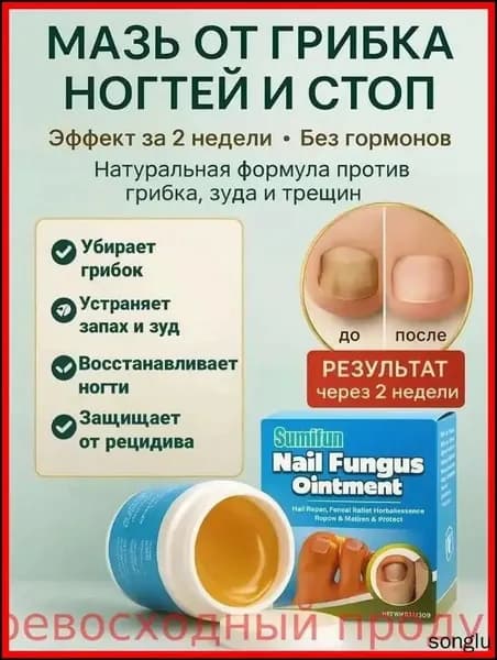 Крем для ногтей и стоп, натуральный уход за ногтевой пластиной, увлажняющая мазь для сухой кожи ног, уход за пятками и педикюр