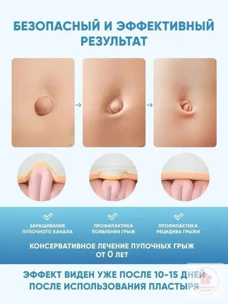 Пластырь от пупочной грыжи детский для новорожденных6 шт.