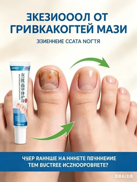 Противогрибковая мазь для лечения грибковых инфекций ногтей на ногах и гиперкератоза противогрибковые препараты для ног