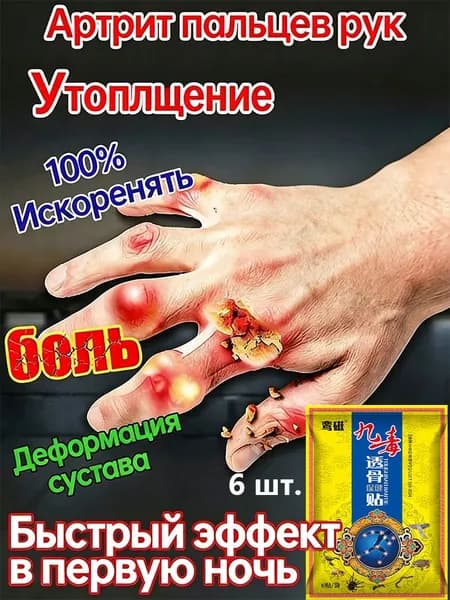 пластырь от подагры,Устранение боли при артрите, коленях, пальцах ног и т. д, на ноге и для рук и артрита
