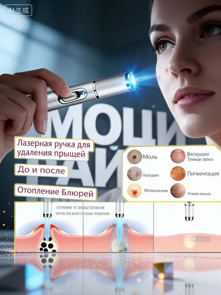 Лазерная ручка для удаления папиллом бородавок и родинок; портативный лазерный коагулятор от пигментных пятен и акне 9 уровней мощности; косметический аппарат для чистки лица без шрамов синий свет