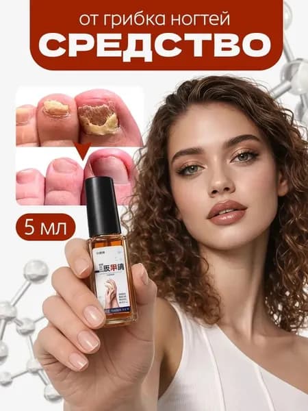 Масло от грибка ногтей на ногах/на руках, онихолизис, гиперкератоз, Nail Glow, 5 мл
