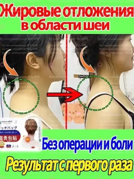 Пластырь от липомы для шеи и спины, быстро устраняет подкожные липомы, облегчает боль и улучшает физиологический изгиб шейного отдела позвоночника, 12 пластырейТравяная смесь