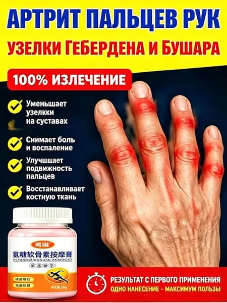 Мазь от подагры,Устранение боли при артрите, коленях, пальцах ног и т. д, на ноге и для рук и артрита 55 г