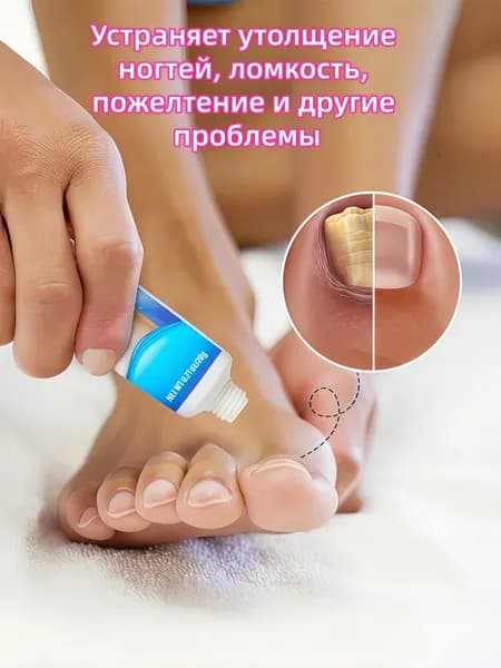 Лечение грибка ногтей для решения проблем с ногтями