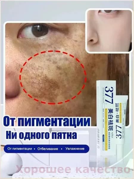 От пигментации Отбеливающий крем от пигментации AofuXue 30