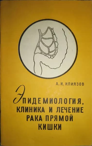 Эпидемиология, клиника и лечение рака прямой кишки