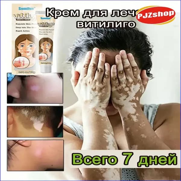 Качественный крем против витилиго, лейкодермы и бурой пигментации, 20 г, для восстановления оттенка кожи-Новинка