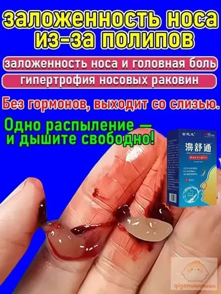 Спрей назальный от полипов в носу Снимает заложенность, зуд и насморк 20 мл
