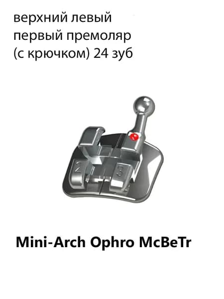 Брекет Mini-Arch Ophro McBeTr, металлический, верхний левый первый премоляр с крючком, 0,56 мм IMD