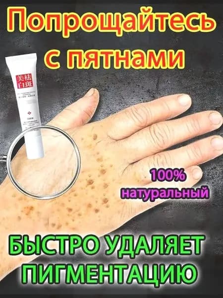 Отбеливающий крем от веснушек и солнечных пятен, подходит для удаления и исчезновения желтых пятен и старчес