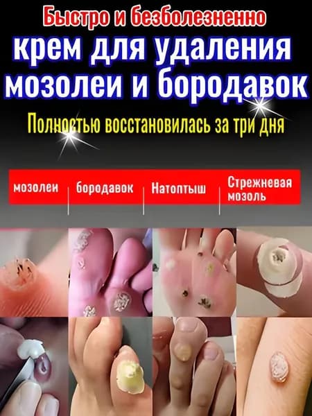 бородавок и натоптышей лечебный Leiko,Средство от стержневых мозолей и ,Средство от шипиц, и сухих стержневыхна ногах мазь и гель Корнекс 20 г