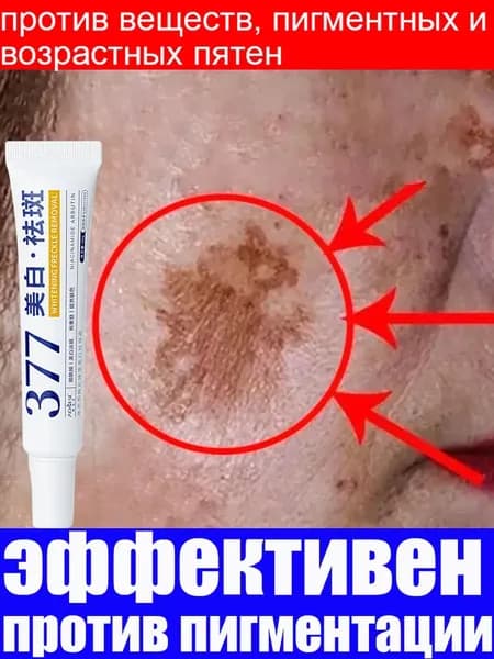 крем против пигментных пятен и веснушек,с Витаминами С и Е, и Гиалуроновой кислотой,Средство против пигментации, осветляющий и увлажняющий,30 г