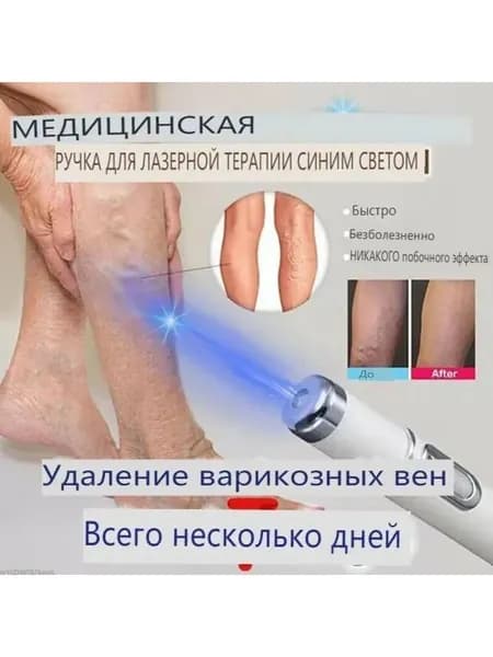 Портативная лазерная ручка для ухода за кожей тела и ног, домашнее косметическое устройство для регулярного ухода