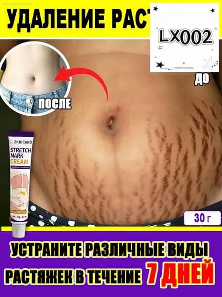 Крем от растяжек уменьшает жировые складки, удаляет растяжки,для тела, для восстановления упругости кожи, питает кожу,30 г